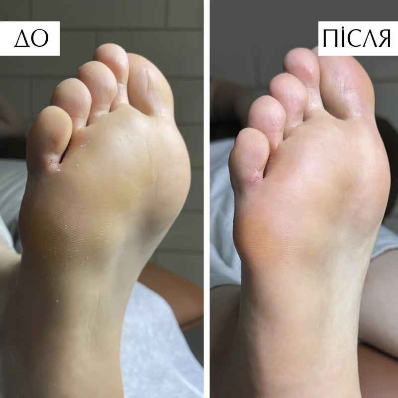 PNB Pedicure Foam 150 мл